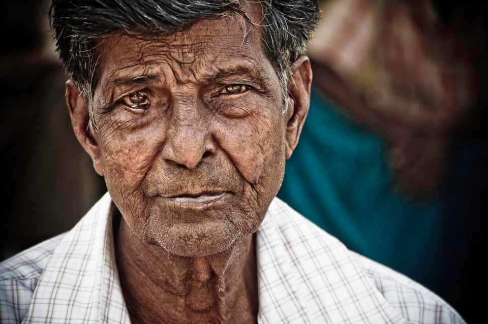 Leprosy: What It Is, What It’s Not, and How You Can Help